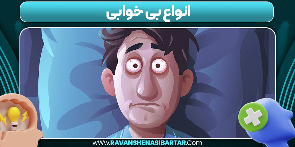 انواع بی خوابی 