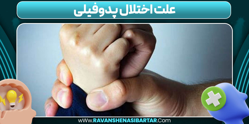 علت اختلال پدوفیلی